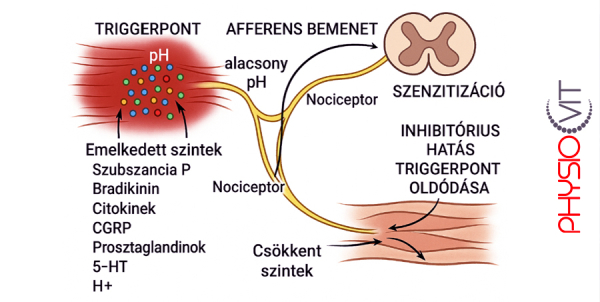 Triggerpontok és gyulladásos mediátorok titokzatos világa: Myofasciális fájdalom szindróma rejtélyei