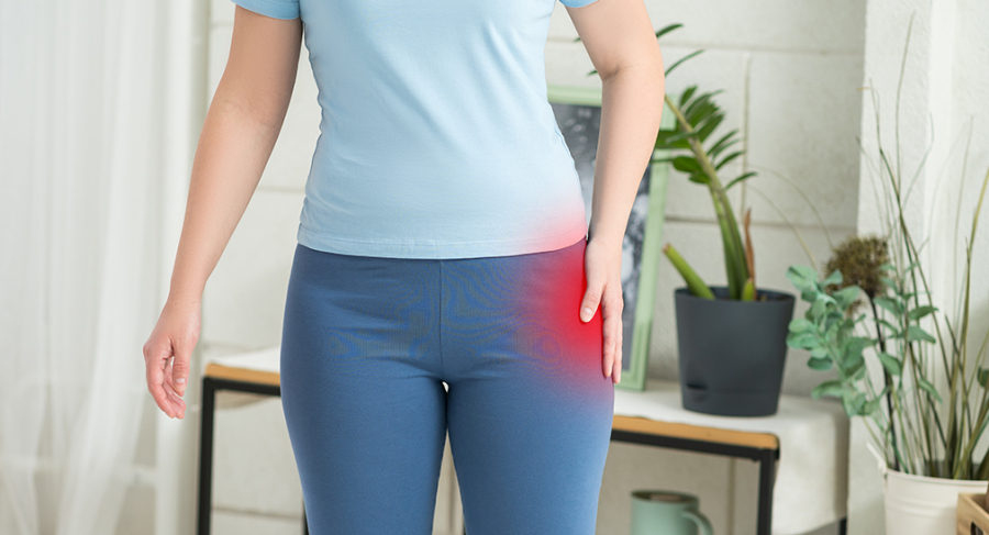Piriformis szindróma: Üdvözöljük a fenék fájdalmának világában!