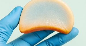 Ízületi porc felépítése és működése közérthetően – PhysioVit Sport és Rehabilitációs Központ, Budapest. - Az ízületi porcszövet felépítése és működése kulcsfontosságú az ízületek egészségéhez. Ismerje meg, hogyan működik a porc, mi a szerepe a synovialis folyadéknak, és mire figyeljen rehabilitáció során! 